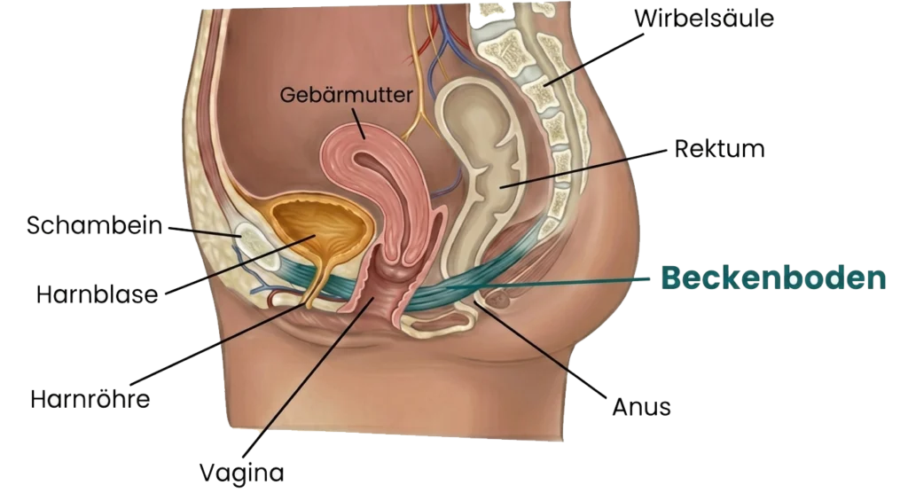 Skizze einer Gebärmuttersenkung